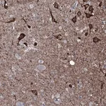Merck Anti-WIPF3 antibody produced in rabbit