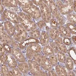 Merck Anti-TIMM8B antibody produced in rabbit