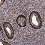 Merck Anti-TXNDC11 antibody produced in rabbit