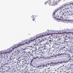 Merck Anti-METTL25 antibody produced in rabbit