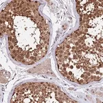 Merck Anti-HERPUD1 antibody produced in rabbit