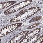 Merck Anti-PPP1R3D antibody produced in rabbit