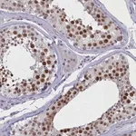 Merck Anti-ATF7IP2 antibody produced in rabbit