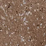 Merck Anti-WIPF3 antibody produced in rabbit