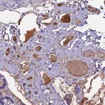 Merck Anti-ANGPTL2 antibody produced in rabbit