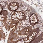 Merck Anti-NUDT8 antibody produced in rabbit