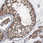 Merck Anti-UBXN6 antibody produced in rabbit