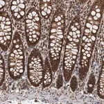 Merck Anti-CFDP1 antibody produced in rabbit