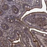 Merck Anti-PROSER2 antibody produced in rabbit