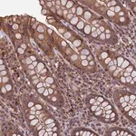 Merck Anti-SLC9A5 antibody produced in rabbit