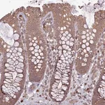 Merck Anti-TIGD7 antibody produced in rabbit