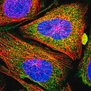 Merck Anti-CCBE1 antibody produced in rabbit