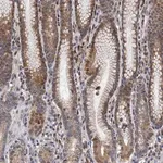 Merck Anti-CMPK2 antibody produced in rabbit