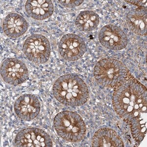 Merck Anti-ANKRD26 antibody produced in rabbit