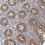 Merck Anti-ANKRD26 antibody produced in rabbit