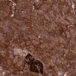 Merck Anti-DDX60L antibody produced in rabbit