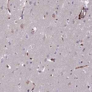 Merck Anti-C15orf59 antibody produced in rabbit