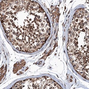 Merck Anti-MDM1 antibody produced in rabbit