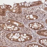 Merck Anti-C19orf44 antibody produced in rabbit