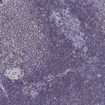 Merck Anti-CCRL2 antibody produced in rabbit