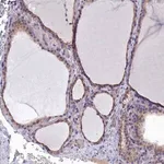 Merck Anti-RABGAP1 antibody produced in rabbit