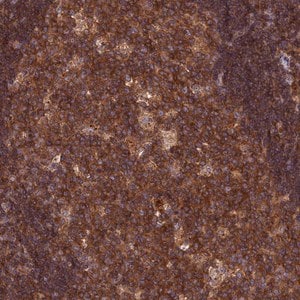 Merck Anti-CPNE7 antibody produced in rabbit