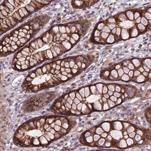 Merck Anti-JMY antibody produced in rabbit