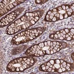 Merck Anti-JMY antibody produced in rabbit