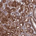 Merck Anti-FAM160B1 antibody produced in rabbit