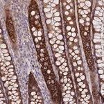 Merck Anti-TMEM44 antibody produced in rabbit