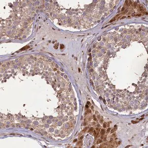 Merck Anti-SLC38A7 antibody produced in rabbit
