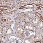 Merck Anti-TSSC4 antibody produced in rabbit