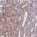 Merck Anti-DIS3L antibody produced in rabbit