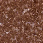 Merck Anti-DHCR7 antibody produced in rabbit