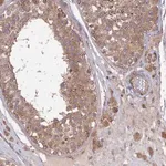 Merck Anti-INCA1 antibody produced in rabbit