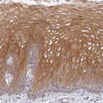 Merck Anti-HOXB1 antibody produced in rabbit