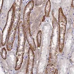 Merck Anti-CHSY3 antibody produced in rabbit
