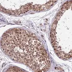 Merck Anti-CDNF antibody produced in rabbit