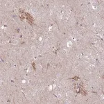 Merck Anti-KCNAB1 antibody produced in rabbit