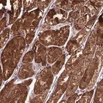 Merck Anti-TBC1D24 antibody produced in rabbit