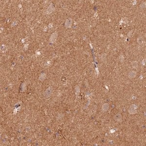 Merck Anti-GNB5 antibody produced in rabbit