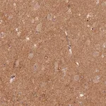 Merck Anti-GNB5 antibody produced in rabbit