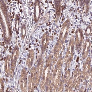 Merck Anti-PPP1R26 antibody produced in rabbit