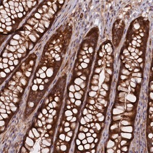 Merck Anti-FERMT1 antibody produced in rabbit