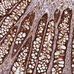 Merck Anti-FERMT1 antibody produced in rabbit