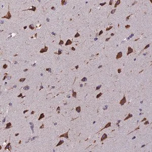 Merck Anti-BTBD3 antibody produced in rabbit