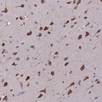 Merck Anti-BTBD3 antibody produced in rabbit