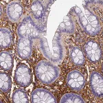 Merck Anti-ITIH1 antibody produced in rabbit