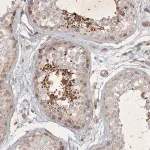 Merck Anti-BOD1 antibody produced in rabbit