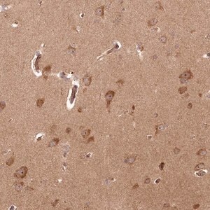 Merck Anti-ARL3 antibody produced in rabbit